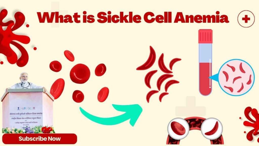 What is Sickle Cell Anemia